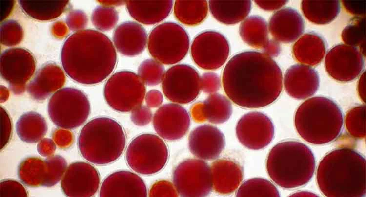 Haematococcus-pluvialis Haematococcus-pluvialis